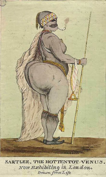Weibliche Genitalverstümmelung und die Hottentottenschürze